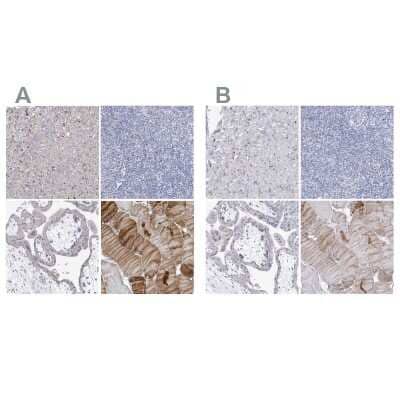 <b>Independent Antibodies Validation. </b>Immunohistochemistry-Paraffin: NRAP Antibody [NBP2-32650] - Staining of human heart muscle, lymphoid tissues, placenta and skeletal muscle using Anti-NRAP antibody NBP2-32650 (A) shows similar protein distribution across tissues to independent antibody NBP1-86267 (B).