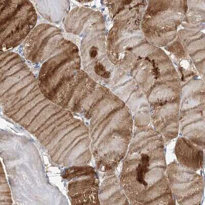Immunohistochemistry-Paraffin: NRAP Antibody [NBP2-32650] - Staining of human skeletal muscle shows moderate to strong cytoplasmic positivity in myocytes.