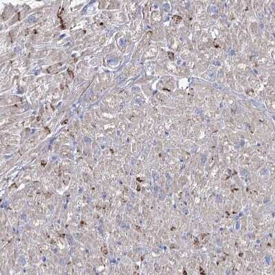 Immunohistochemistry-Paraffin: NRAP Antibody [NBP2-32650] - Staining of human heart muscle shows strong positivity in intercalated discs in myocytes.