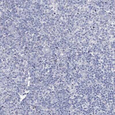 Immunohistochemistry-Paraffin NRAP Antibody - BSA Free