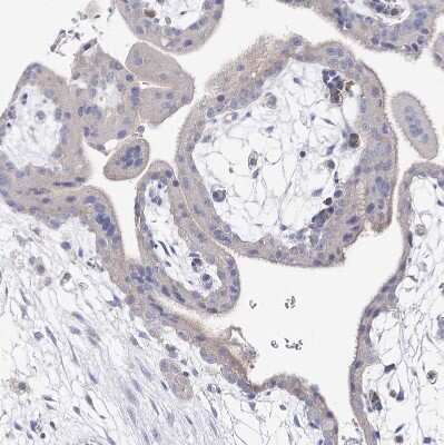 Immunohistochemistry-Paraffin: NRAP Antibody [NBP2-32650] - Staining of human placenta shows no positivity in trophoblastic cells as expected.