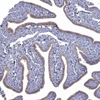 Immunohistochemistry-Paraffin: NRARP Antibody [NBP1-82665] - Staining of human Fallopian tube shows moderate cytoplasmic positivity in glandular cells.