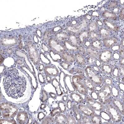 Immunohistochemistry-Paraffin: NRARP Antibody [NBP1-82665] - Staining of human Kidney shows moderate cytoplasmic positivity in cells in tubules.