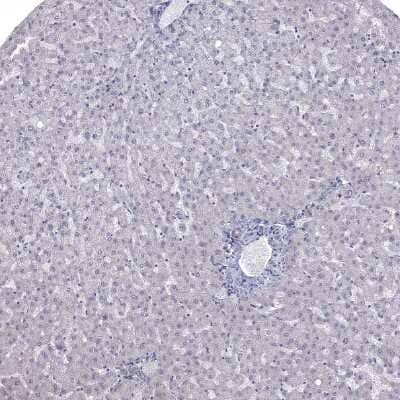 Immunohistochemistry-Paraffin: NRARP Antibody [NBP1-82665] - Staining of human Liver shows no positivity in hepatocytes as expected.