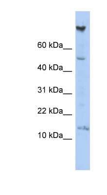 Western Blot NRARP Antibody - BSA Free