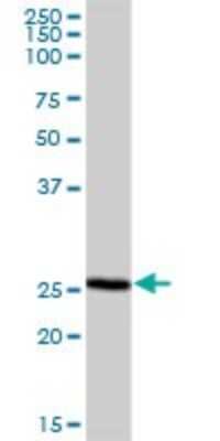 Western Blot: NRBF2 Antibody [H00029982-B02P] - Analysis of NRBF2 expression in human liver.