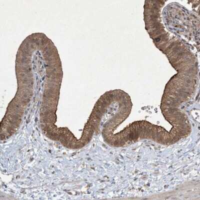 Immunohistochemistry-Paraffin: NRBP2 Antibody [NBP1-85101] - Staining of human gallbladder shows strong cytoplasmic positivity in glandular cells.