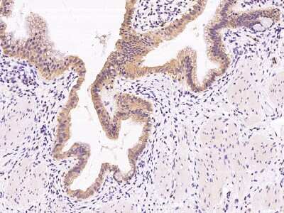 Immunohistochemistry-Paraffin: NRBP2 Antibody [NBP2-99226] - Immunochemical staining of human NRBP2 in human gallbladder with rabbit polyclonal antibody at 1:300 dilution, formalin-fixed paraffin embedded sections.