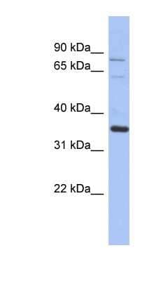 Western Blot: NRBP2 Antibody [NBP1-54969] - Human Placenta lysate, concentration 0.2-1 ug/ml.