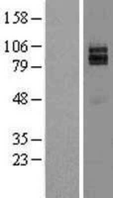 Western Blot: NRG1 Overexpression Lysate (Adult Normal) [NBL1-13790] Left-Empty vector transfected control cell lysate (HEK293 cell lysate); Right -Over-expression Lysate for NRG1.