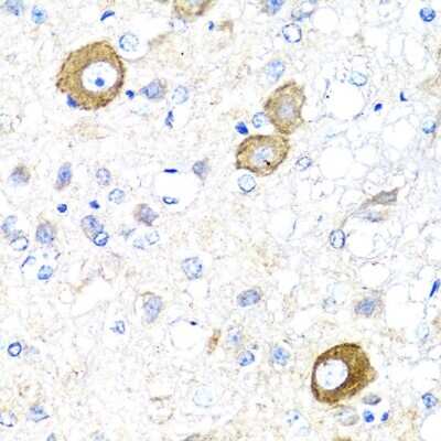 Immunohistochemistry-Paraffin: NRG4 Antibody [NBP2-93954] - Paraffin-embedded rat brain using NRG4 .