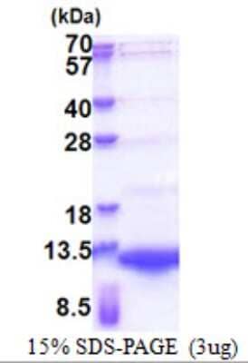 SDS-Page: NRG4 Protein [NBP2-23278]