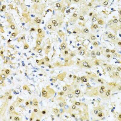 Immunohistochemistry-Paraffin: NRIF3 Antibody [NBP3-03238] - Paraffin-embedded human liver using NRIF3 antibody at dilution of 1:100 (40x lens).