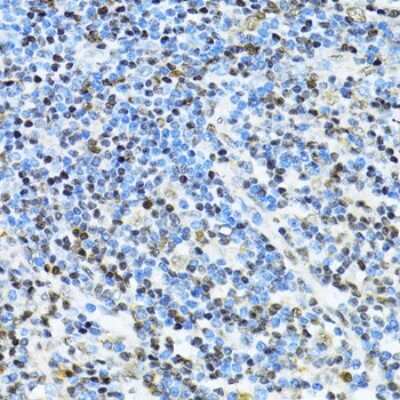 Immunohistochemistry-Paraffin: NRIF3 Antibody [NBP3-03238] - Paraffin-embedded human appendix using NRIF3 antibody at dilution of 1:100 (40x lens).