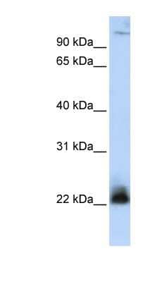 Western Blot: NRIF3 Antibody [NBP1-59187] - Titration: 0.2-1 ug/ml, Positive Control: MCF7 cell lysate.