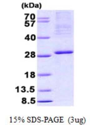 SDS-PAGE Recombinant Human NRIF3 His Protein