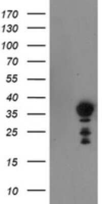 Western Blot: NRIP3 Antibody (OTI1A9) - Azide and BSA Free [NBP2-73066] - Analysis of HEK293T cells were transfected with the pCMV6-ENTRY control (Left lane) or pCMV6-ENTRY NRIP3.