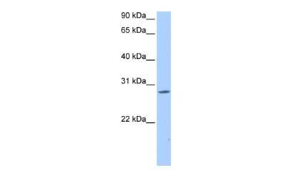 Western Blot: NRIP3 Antibody [NBP3-09281] - Western blot analysis of NRIP3 in 721_B cell lysate as a positive control. Antibody dilution at 0.2-1 ug/ml