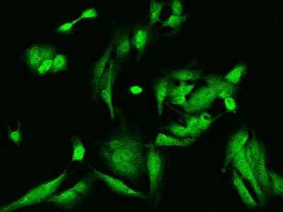 Immunocytochemistry/Immunofluorescence: NRK Antibody [NBP2-98072] - Immunofluorescence staining of NRK in U251MG cells. Cells were fixed with 4% PFA, permeabilzed with 0.1% Triton X-100 in PBS, blocked with 10% serum, and incubated with rabbit anti-Human NRK polyclonal antibody (dilution ratio 1:200) at 4C overnight. Then cells were stained with the Alexa Fluor(R)488-conjugated Goat Anti-rabbit IgG secondary antibody (green). Positive staining was localized to Nucleus and Cytoplasm.