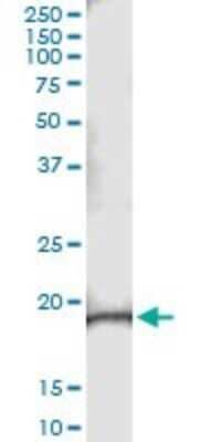 Immunoprecipitation NRK1 Antibody (2A10) - Azide and BSA Free