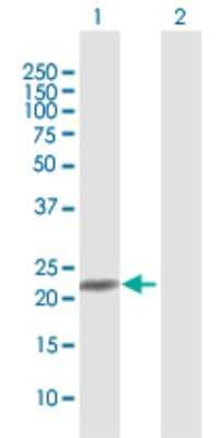 Western Blot: NRK1 Antibody [H00054981-D01P] - Analysis of C9orf95 expression in transfected 293T cell line by C9orf95 polyclonal antibody.Lane 1: C9orf95 transfected lysate(23.20 KDa).Lane 2: Non-transfected lysate.