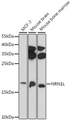 Western Blot: NRN1L Antibody [NBP2-94688] - Analysis of extracts of various cell lines, using NRN1L at 1:1000 dilution.Secondary antibody: HRP Goat Anti-Rabbit IgG (H+L) at 1:10000 dilution.Lysates/proteins: 25ug per lane.Blocking buffer: 3% nonfat dry milk in TBST.Detection: ECL Basic Kit .Exposure time: 10s.
