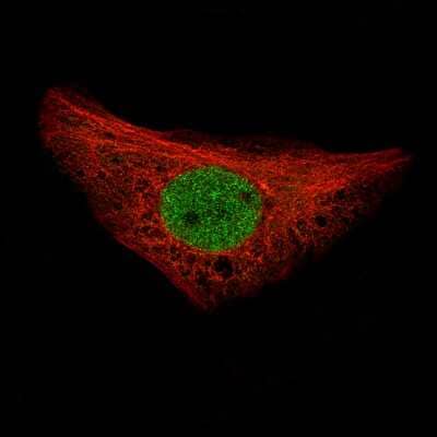 Immunocytochemistry/Immunofluorescence: NRSF Antibody (CL0381) [NBP2-42048] - Staining of U-2 OS cells using the Anti-REST monoclonal antibody, showing specific staining in the nucleoplasm in green. Microtubule- and nuclear probes are visualized in red and blue, respectively (where available).