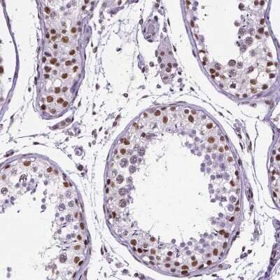 Immunohistochemistry-Paraffin NRSF Antibody (CL0381)