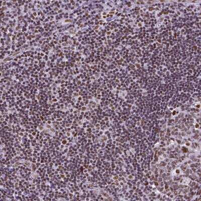 Immunohistochemistry-Paraffin NRSF Antibody (CL0381)