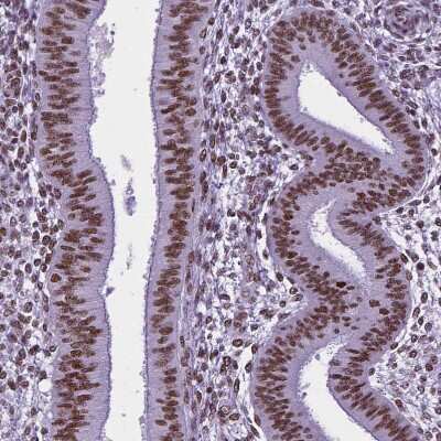 Immunohistochemistry-Paraffin NRSF Antibody (CL0381)