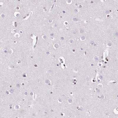 Immunohistochemistry-Paraffin: NRSF Antibody (CL0381) [NBP2-42048] - Staining of human cerebral cortex shows no nuclear positivity in neuronal cells as expected.