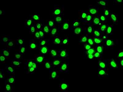 Immunocytochemistry/Immunofluorescence: NRSF Antibody [NBP3-03798] - Analysis of MCF-7 cells using NRSF antibody .