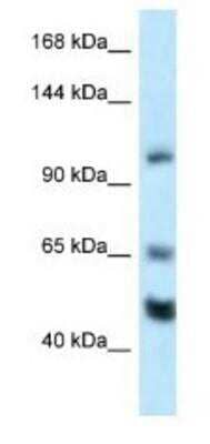 Western Blot: NRSF Antibody [NBP1-82399] - Mouse Heart Lysate 1ug/ml Gel Concentration 6-18%