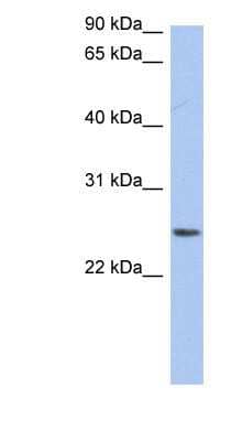 Western Blot: NRSN2 Antibody [NBP1-59831] - THP-1 cell lysate, concentration 0.2-1 ug/ml.