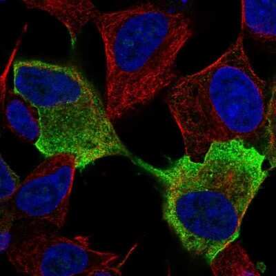 Immunocytochemistry/Immunofluorescence: NRXN1 Antibody [NBP2-68920] - Staining of human cell line SH-SY5Y shows localization to plasma membrane.