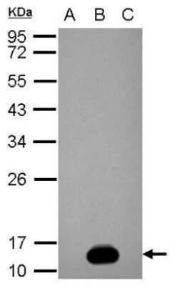 Western Blot: NS2B Antibody [NBP2-42891] - Analysis of 20 ug whole cell lysate. A: BHK-21 B: Dengue virus 2 infect BHK-21 C: Japanese encephalitis virus infect BHK-21 15% SDS PAGE diluted at 1:5000.