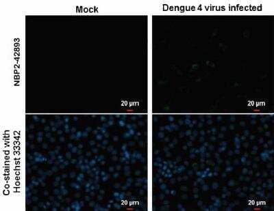 Immunocytochemistry/Immunofluorescence: NS3 Antibody [NBP2-42893] - Analysis of Samples: BHK-21 cells mock (left) and infected with Dengue virus 4 (right) were fixed in MeOH. Green: NS3 (Dengue virus) protein stained by NS3 (Dengue virus) antibody diluted at 1:2000. Blue: Hoechst 33342 staining.