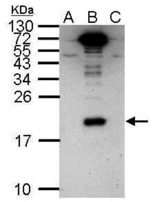 Western Blot: NS4A Antibody [NBP2-42894] - Analysis of 20 ug whole cell lysate. A: BHK-21 B: Dengue virus 2 infect BHK-21 C: JEV infect BHK-21 12% SDS PAGE diluted at 1:1000.