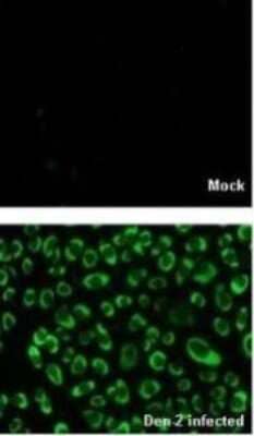 Immunocytochemistry/Immunofluorescence: NS4B Antibody [NBP2-42895] - Analysis of Denque virus 2-infected BHK-21, using Non-structural protein 4B (Dengue virus 2 ) antibody at 1:2000 dilution.