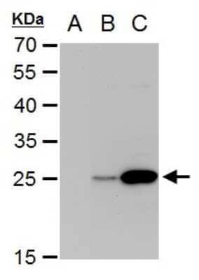 Western Blot: NS4B Antibody [NBP2-42895] - Analysis of A. 30 ug BHK-21 whole cell extrac B. 30 ug whole cell extract of Dengue virus type 2 infected BHK-21 cells C. 30 ug whole cell extract of Dengue virus type 3 infected BHK-21 cells 12 % SDS-PAGE NS4B (Dengue virus) antibody dilution: 1:5000