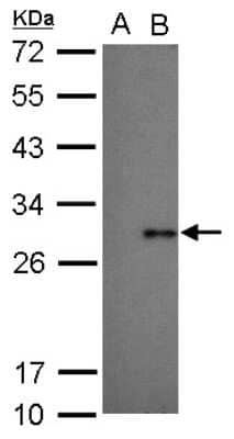Western Blot: NS4B Antibody [NBP2-42896] - Analysis of 20 ug sample A: BHK-21 B: Dengue virus 2 infect BHK-21 12% SDS PAGE diluted at 1:1000.