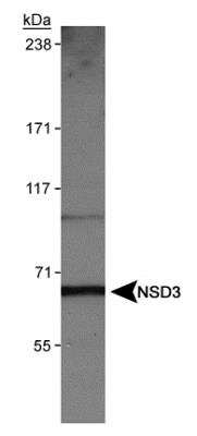 Western Blot: NSD3 Antibody [NBP1-04991] - Detection of NSD3 (isoform 3) in HeLa nuclear extracts using NBP1-04991.
