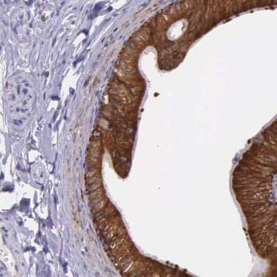 Immunohistochemistry-Paraffin: NSDHL Antibody [NBP1-83306] - Staining of human epididymis shows high expression.