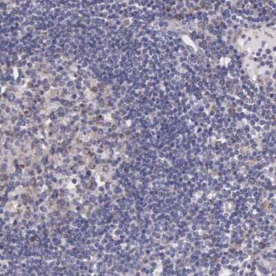 Immunohistochemistry-Paraffin: NSDHL Antibody [NBP1-83306] - Staining of human lymph node shows low expression as expected.