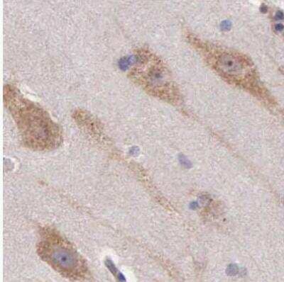 Immunohistochemistry-Paraffin: NSDHL Antibody [NBP1-83306] - Staining of human cerebral cortex using Anti-NSDHL antibody.