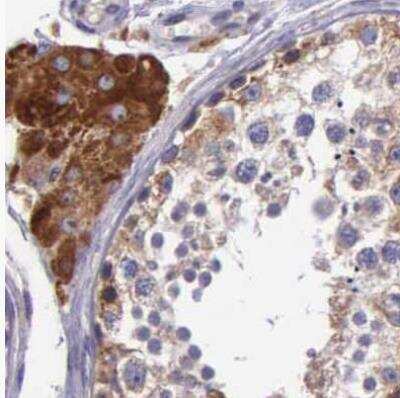 Immunohistochemistry-Paraffin: NSDHL Antibody [NBP1-83306] - Staining of human testis using Anti-NSDHL antibody.