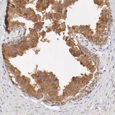 Immunohistochemistry-Paraffin: NSDHL Antibody [NBP1-83307] - Staining of human epididymis shows high expression.