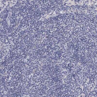 Immunohistochemistry-Paraffin: NSDHL Antibody [NBP1-83307] - Staining of human lymph node shows low expression as expected.