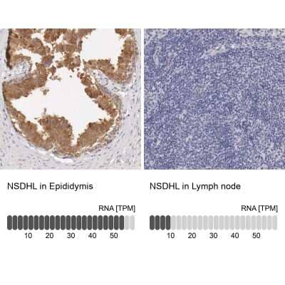 Immunohistochemistry-Paraffin: NSDHL Antibody [NBP1-83307] - Staining in human epididymis and lymph node tissues using anti-NSDHL antibody. Corresponding NSDHL RNA-seq data are presented for the same tissues.