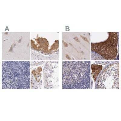 <b>Independent Antibodies Validation and Orthogonal Strategies Validation.</b>Immunohistochemistry-Paraffin: NSDHL Antibody [NBP1-83307] - Staining of human cerebral cortex, epididymis, lymph node and testis using Anti-NSDHL antibody NBP1-83307 (A) shows similar protein distribution across tissues to independent antibody NBP1-83306 (B).